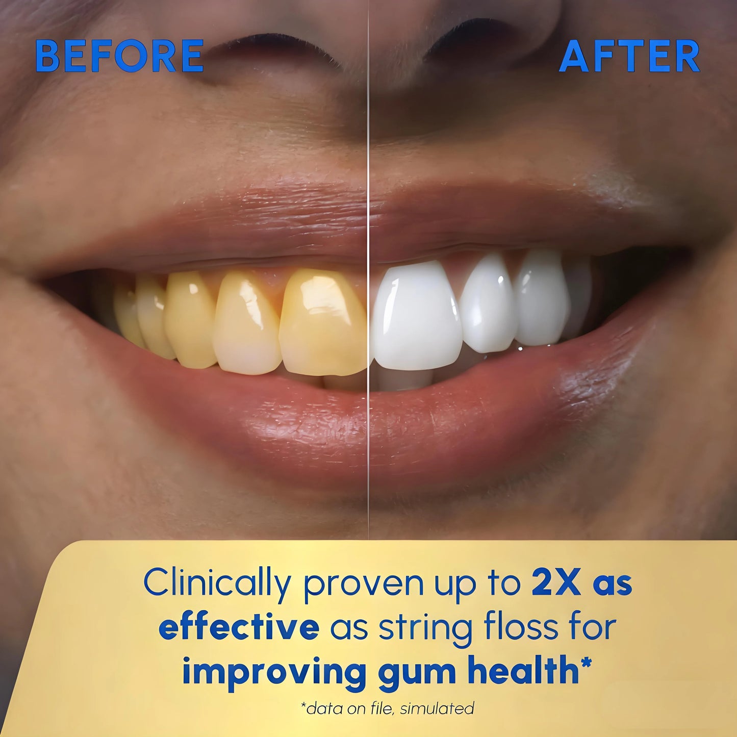 Advanced 2.0 Cordless Water Flosser: Dental Care for Teeth/Gums/Braces, 4 Tips, Travel Bag, ADA Accepted